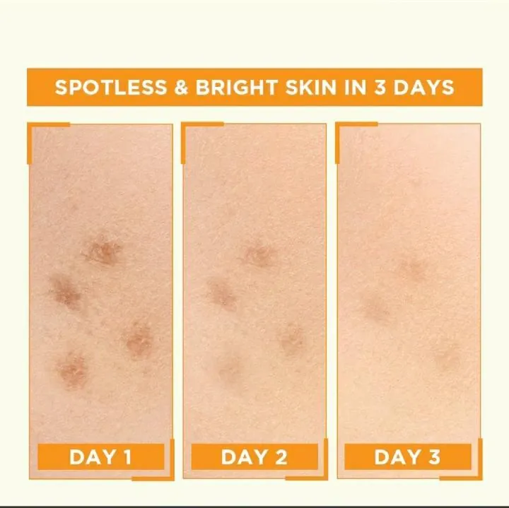 Garnier Skin Naturals Vitamin C Serum 30ml – Dark Spot & Brightening Face Serum - Image 2